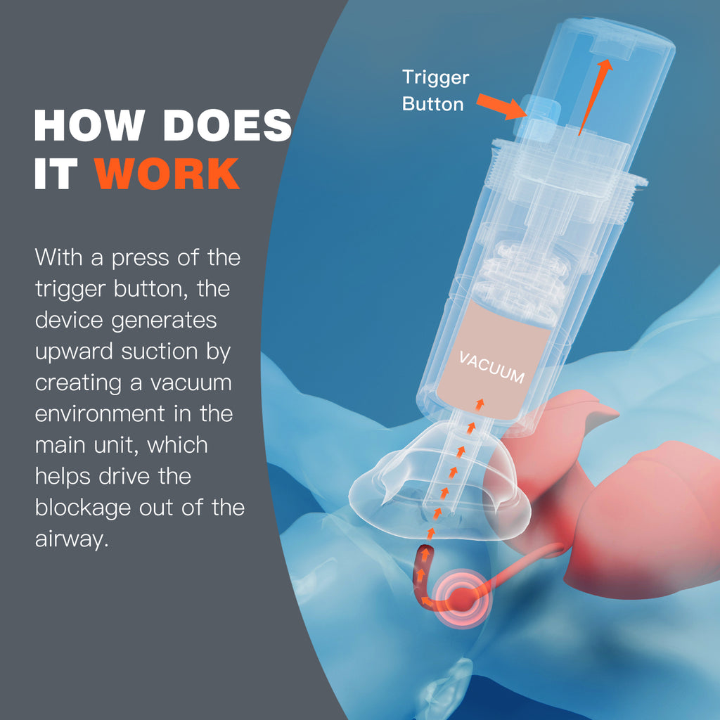 Anti-Choking Device for Emergency Airway Assistance