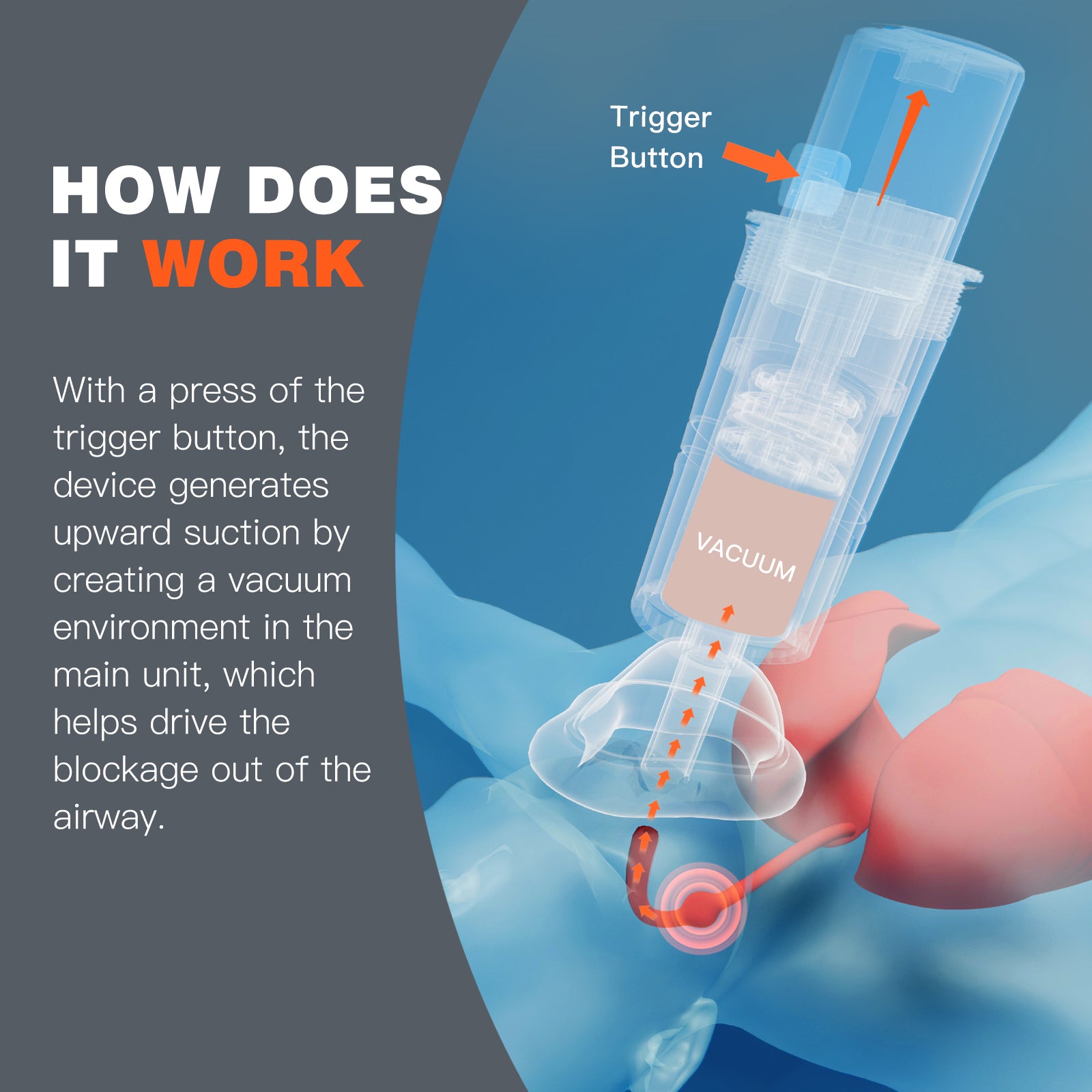 Anti-Choking Device for Emergency Airway Assistance